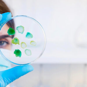 ilustración del gen BCMO1 y su relación con la dieta vegana alimentos vegetales ricos en betacarotenos