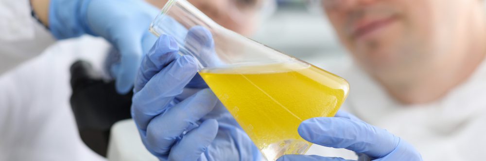 análisis científico del zumo de patata cruda para el estómago en laboratorio